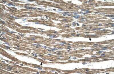 Immunohistochemistry-Paraffin: GATD3A Antibody [NBP1-80552] - Human Muscle Tissue, Skeletal muscle cells (Indicated with Arrows) 4-8ug/ml.