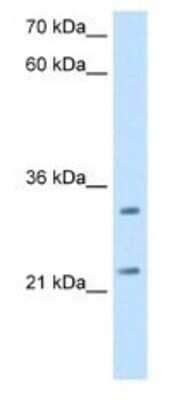 Western Blot: GATD3A Antibody [NBP1-80552] - HepG2 Cell Lysate 2.5ug/ml Gel Concentration 12%