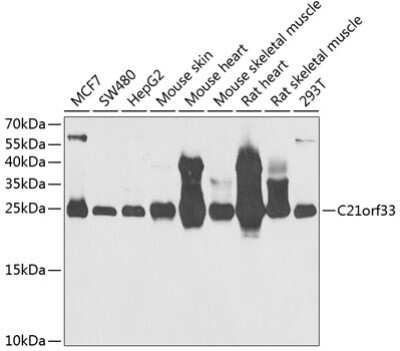 Western Blot: GATD3A Antibody [NBP3-03727] - Analysis of extracts of various cell lines, using GATD3A antibody at 1:1000 dilution. Secondary antibody: HRP Goat Anti-Rabbit IgG (H+L) at 1:10000 dilution. Lysates/proteins: 25ug per lane. Blocking buffer: 3% nonfat dry milk in TBST. Detection: ECL Enhanced Kit.