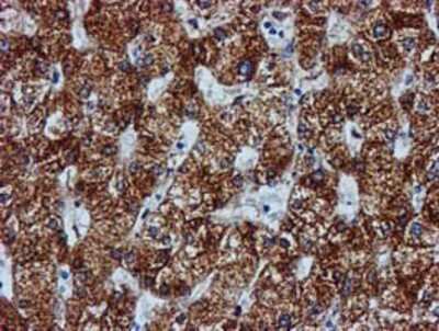 Immunohistochemistry-Paraffin: GATM Antibody (1E3) [NBP2-00984] - Staining of paraffin-embedded Human liver tissue using anti-GATM mouse monoclonal antibody.