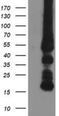 Western Blot: GATM Antibody (1E3) [NBP2-00984] - HEK293T cells were transfected with the pCMV6-ENTRY control (Left lane) or pCMV6-ENTRY GATM (Right lane) cDNA for 48 hrs and lysed. Equivalent amounts of cell lysates (5 ug per lane) were separated by SDS-PAGE and immunoblotted with anti-GATM.