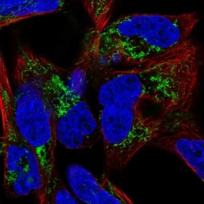 Immunocytochemistry/Immunofluorescence: GATM Antibody [NBP1-89211] - Staining of human cell line RH-30 shows localization to mitochondria. Antibody staining is shown in green.