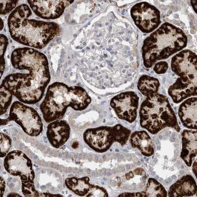 Immunohistochemistry-Paraffin: GATM Antibody [NBP1-89211] - Staining of human kidney shows moderate to strong cytoplasmic positivity in cells in tubules.