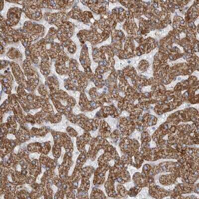 Immunohistochemistry-Paraffin: GATM Antibody [NBP1-89211] - Staining of human liver shows moderate to strong cytoplasmic positivity in hepatocytes.