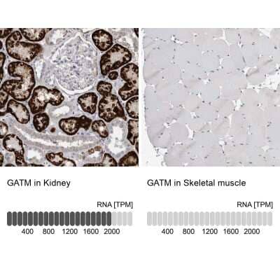 Immunohistochemistry-Paraffin GATM Antibody - BSA Free