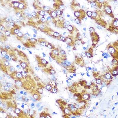 Immunohistochemistry-Paraffin: GATM Antibody [NBP3-04578] - Immunohistochemistry of paraffin-embedded human liver using GATM Rabbit pAb (NBP3-04578) at dilution of 1:100 (40x lens). Perform microwave antigen retrieval with 10 mM PBS buffer pH 7.2 before commencing with IHC staining protocol.