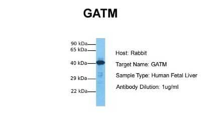 Western Blot: GATM Antibody [NBP1-54764] - Sample Tissue: Human Fetal Liver Antibody Dilution: 1.0 ug/ml