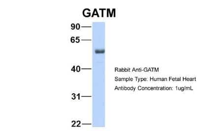 Western Blot: GATM Antibody [NBP1-54764] - Sample Type: Human Fetal Heart Antibody Dilution: 1.0 ug/ml