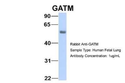 Western Blot: GATM Antibody [NBP1-54764] - Sample Type: Human Fetal Lung Antibody Dilution: 1.0 ug/ml