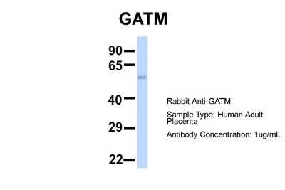 Western Blot: GATM Antibody [NBP1-54764] - Sample Type: Human Adult Placenta Antibody Dilution: 1.0 ug/ml