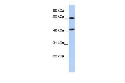 Western Blot: GATM Antibody [NBP1-54764] - Reccomended Titration: 0.2 - 1 ug/ml ELISA Titer: 1:62500 Positive Control: 721_B cell lysate GATM is strongly supported by BioGPS gene expression data to be expressed in Human 721_B cells