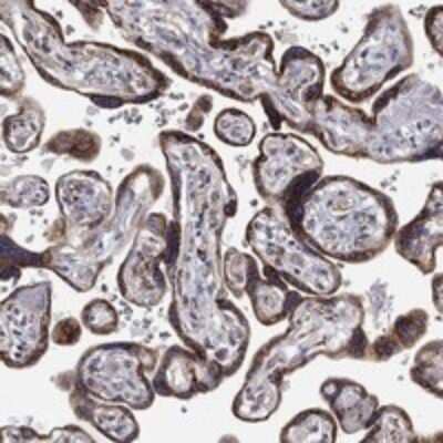 Immunohistochemistry-Paraffin: GATSL3 Antibody [NBP3-17496] - Staining of human placenta shows strong cytoplasmic positivity in trophoblastic cells.