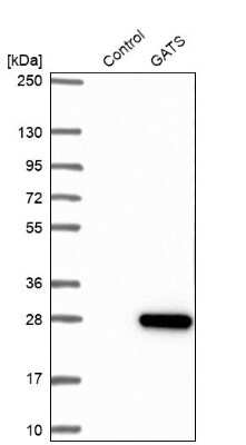 Western Blot: GATSL3 Antibody [NBP1-84120] - Analysis in control (vector only transfected HEK293T lysate) and GATS over-expression lysate (Co-expressed with a C-terminal myc-DDK tag (3.1 kDa) in mammalian HEK293T cells).