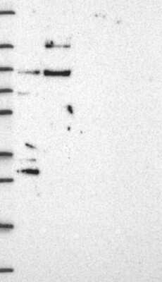 Western Blot: GATSL3 Antibody [NBP3-17496] - Lane 1: Marker [kDa] 250, 130, 95, 72, 55, 36, 28, 17, 10;   Lane 2: RT4;   Lane 3: U-251 MG;   Lane 4: Human Plasma;   Lane 5: Liver;   Lane 6: Tonsil