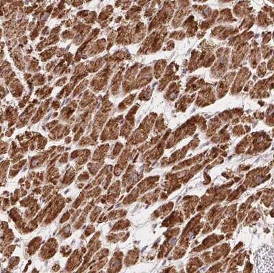 Immunohistochemistry-Paraffin: GBAS Antibody [NBP2-38984] - Staining of human heart muscle shows strong cytoplasmic positivity in cardiomyocytes.