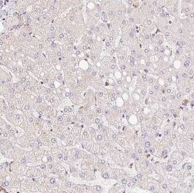 Immunohistochemistry-Paraffin: GBAS Antibody [NBP2-38984] - Staining of human liver shows only very weak positivity in hepatocytes as expected.