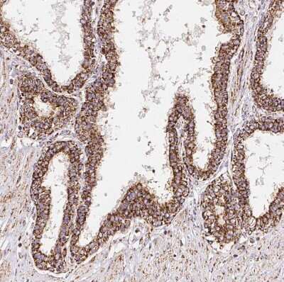 Immunohistochemistry-Paraffin: GBAS Antibody [NBP2-38984] - Staining of human prostate shows moderate granular cytoplasmic positivity in glandular cells.