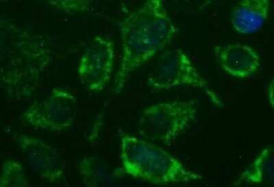 Immunocytochemistry/Immunofluorescence: GBAS Antibody (OTI1B8) - Azide and BSA Free [NBP2-70804] - Analysis of HeLa.