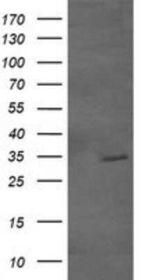 Western Blot: GBAS Antibody (OTI1B8) - Azide and BSA Free [NBP2-70804] - Analysis of HEK293T cells were transfected with the pCMV6-ENTRY control (Left lane) or pCMV6-ENTRY GBAS.