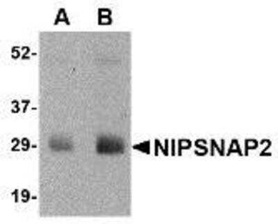 Western Blot: GBAS Antibody [NBP1-76966] - Human skeletal muscle tissue lysate with NIPSNAP2 antibody at (A) 0.5 and (B) 1 ug/ml.