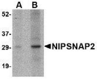 Western Blot: GBAS Antibody [NBP1-77339] - Human skeletal muscle tissue lysate with GBAS antibody at (A) 1 and (B) 2 ug/ml.