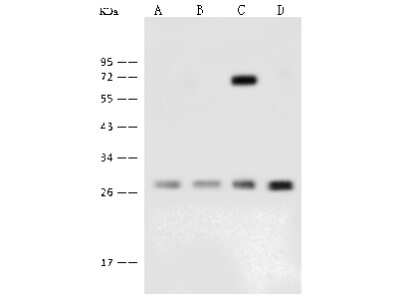 Western Blot: GBAS Antibody [NBP2-99373] - Anti-GBAS rabbit polyclonal antibody at 1:500 dilution. Lane A: THP1 Whole Cell Lysate Lane B: A549 Whole Cell Lysate Lane C: H1299 Whole Cell Lysate Lane D: HCT116 Whole Cell Lysate Lysates/proteins at 30 ug per lane. Secondary Goat Anti-Rabbit IgG (H+L)/HRP at 1/10000 dilution. Developed using the ECL technique. Performed under reducing conditions. Predicted band size: 34 kDa. Observed band size: 28 kDa
