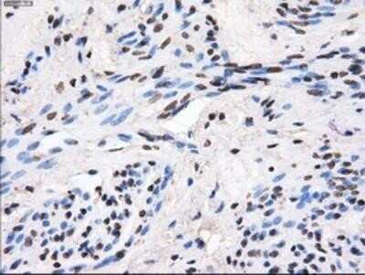 Immunohistochemistry: GBE1 Antibody (OTI1D11) - Azide and BSA Free [NBP2-70810] - Staining of paraffin-embedded Human endometrium tissue using anti-GBE1 mouse monoclonal antibody.