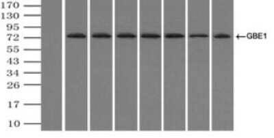 Immunoprecipitation: GBE1 Antibody (OTI1D11) - Azide and BSA Free [NBP2-70810] - (Negative control: IP without adding anti-GBE1 antibody.). For each experiment, 500ul of DDK tagged GBE1 overexpression lysates (at 1:5 dilution with HEK293T lysate), 2ug of anti-GBE1 antibody and 20ul (0.1mg) of goat anti-mouse conjugated magnetic beads were mixed and incubated overnight. After extensive wash to remove any non-specific binding, the immuno-precipitated products were analyzed with rabbit anti-DDK polyclonal antibody.