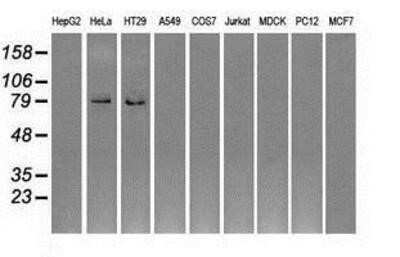 Western Blot GBE1 Antibody (OTI1D11) - Azide and BSA Free