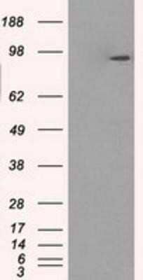 Western Blot: GBE1 Antibody (OTI1D11) - Azide and BSA Free [NBP2-70810] - HEK293T cells were transfected with the pCMV6-ENTRY control (Left lane) or pCMV6-ENTRY GBE1 (Right lane) cDNA for 48 hrs and lysed. Equivalent amounts of cell lysates (5 ug per lane) were separated by SDS-PAGE and immunoblotted with anti-GBE1.