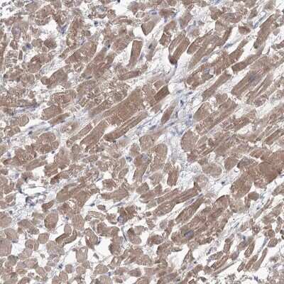 Immunohistochemistry-Paraffin: GBF1 Antibody [NBP1-88844] - Staining of human heart muscle shows cytoplasmic positivity in myocytes.