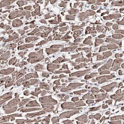 Immunohistochemistry-Paraffin: GBF1 Antibody [NBP2-14039] - Staining of human heart muscle shows cytoplasmic positivity in myocytes.