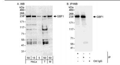Immunoprecipitation: GBF1 Antibody [NBP1-06526] - Whole cell lysate from HeLa (5, 15 and 50 ug for WB; 1 mg for IP, 20% of IP loaded), 293T (T; 50 ug) and mouse NIH3T3 (M; 50 ug) cells. NBP1-06526 used for WB at 0.04 ug/ml (A) and 1 ug/ml (B) and used for IP at 3 ug/mg lysate. GBF1 was also immunoprecipitated by NBP1-06525 which recognizes an upstream epitope.