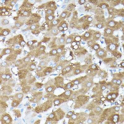 Immunohistochemistry-Paraffin: GBL Antibody [NBP3-03451] - Immunohistochemistry of paraffin-embedded human liver using GBL Rabbit pAb (NBP3-03451) at dilution of 1:100 (40x lens). Perform high pressure antigen retrieval with 10 mM citrate buffer pH 6.0 before commencing with IHC staining protocol.