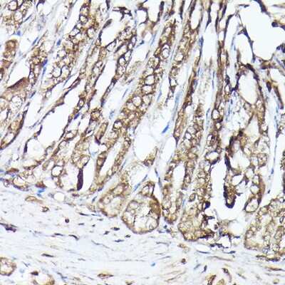 Immunohistochemistry-Paraffin: GBL Antibody [NBP3-03451] - Immunohistochemistry of paraffin-embedded mouse stomach using GBL Rabbit pAb (NBP3-03451) at dilution of 1:100 (40x lens). Perform high pressure antigen retrieval with 10 mM citrate buffer pH 6.0 before commencing with IHC staining protocol.