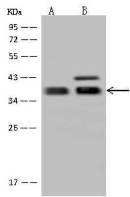 Western Blot: GBL Antibody [NBP2-98484] - Anti-GBL rabbit polyclonal antibody at 1:500 dilution. Lane A: HeLa Whole Cell Lysate Lane B: U-251 MG Whole Cell Lysate Lysates/proteins at 30 ug per lane. Secondary Goat Anti-Rabbit IgG (H+L)/HRP at 1/10000 dilution. Developed using the ECL technique. Performed under reducing conditions. Predicted band size: 35 kDa. Observed band size: 38 kDa (We are unsure as to the identity of these extra bands).