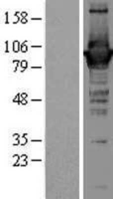 Western Blot: GBP1 Overexpression Lysate (Adult Normal) [NBL1-10996] Left-Empty vector transfected control cell lysate (HEK293 cell lysate); Right -Over-expression Lysate for GBP1.