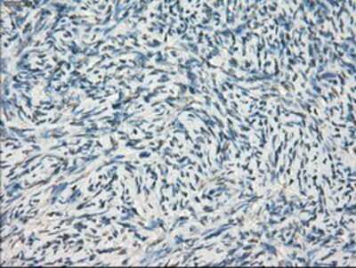 Immunohistochemistry-Paraffin: GBP2 Antibody (OTI5C8) [NBP1-47768] -  Staining of paraffin-embedded Human Ovary tissue using anti-GBP2 mouse monoclonal antibody.