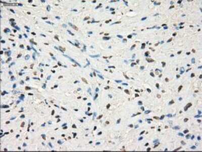 Immunohistochemistry-Paraffin: GBP2 Antibody (OTI5C8) [NBP1-47768] - Staining of paraffin-embedded Human prostate tissue using anti-GBP2 mouse monoclonal antibody.