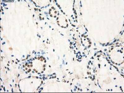 Immunohistochemistry-Paraffin: GBP2 Antibody (OTI5C8) [NBP1-47768] - Staining of paraffin-embedded Human thyroid tissue using anti-GBP2 mouse monoclonal antibody.