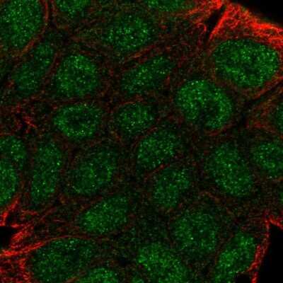 Immunocytochemistry/Immunofluorescence: GBP2 Antibody [NBP2-48771] - Immunofluorescent staining of human cell line RT4 shows localization to nucleoplasm & cytosol.