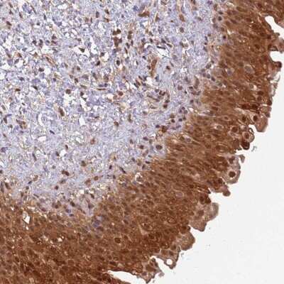 Immunohistochemistry-Paraffin: GBP2 Antibody [NBP2-48771] - Staining of human urinary bladder shows distinct cytoplasmic and nuclear positivity in urothelial cells.