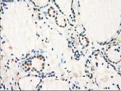 Immunohistochemistry: GBP2 Antibody (OTI5C8) - Azide and BSA Free [NBP2-70812] - Staining of paraffin-embedded Human thyroid tissue using anti-GBP2 mouse monoclonal antibody.