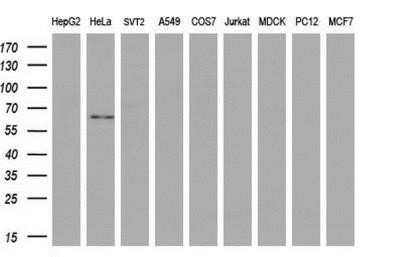 Western Blot: GBP2 Antibody (OTI5C8) - Azide and BSA Free [NBP2-70812] - Analysis of extracts (35ug) from 9 different cell lines by using anti-GBP2 monoclonal antibody (HepG2: human; HeLa: human; SVT2: mouse; A549: human; COS7: monkey; Jurkat: human; MDCK: canine; PC12: rat; MCF7: human).(1:200)