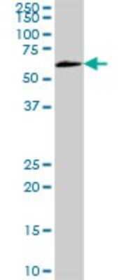 Western Blot: GBP2 Antibody [H00002634-B01P] - Analysis of GBP2 expression in human liver.