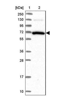 Western Blot GBP2 Antibody