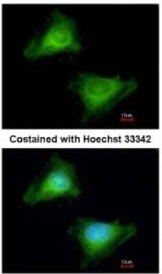 Immunocytochemistry/ Immunofluorescence GBP3 Antibody