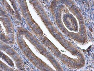 Immunohistochemistry-Paraffin: GBP3 Antibody [NBP1-31714] - Human endometrium. GBP3 antibody [N1C1] diluted at 1:500. Antigen Retrieval: Citrate buffer, pH 6.0, 15 min.