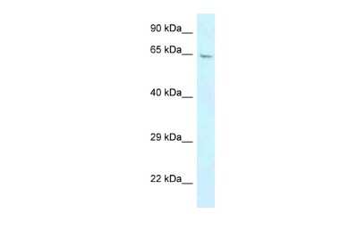 Western Blot: GBP3 Antibody [NBP2-84959] - WB Suggested Anti-GBP3 Antibody. Titration: 1.0 ug/ml. Positive Control: Placenta