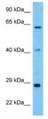 Western Blot: GBP3 Antibody [NBP3-10284] - Western blot analysis of GBP3 in Mouse Brain lysates. Antibody dilution at 1ug/ml